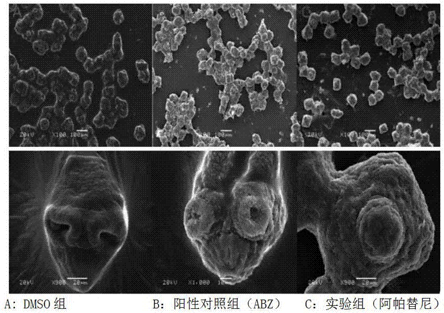 Application of apatinib serving as medicine for treating echinococcosis