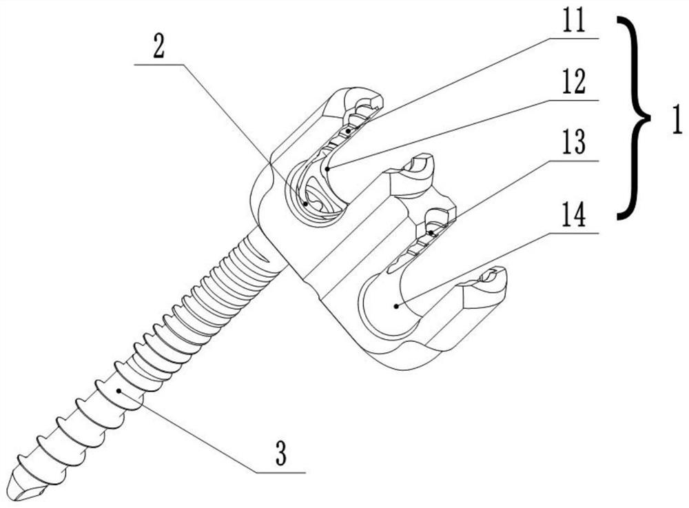 Connecting assembly of spine orientation double-end screw