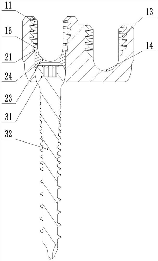 Connecting assembly of spine orientation double-end screw