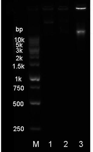 Extracellular vesicle detection technology based on aptamer hairpin-type triggered super-branch rolling ring amplification