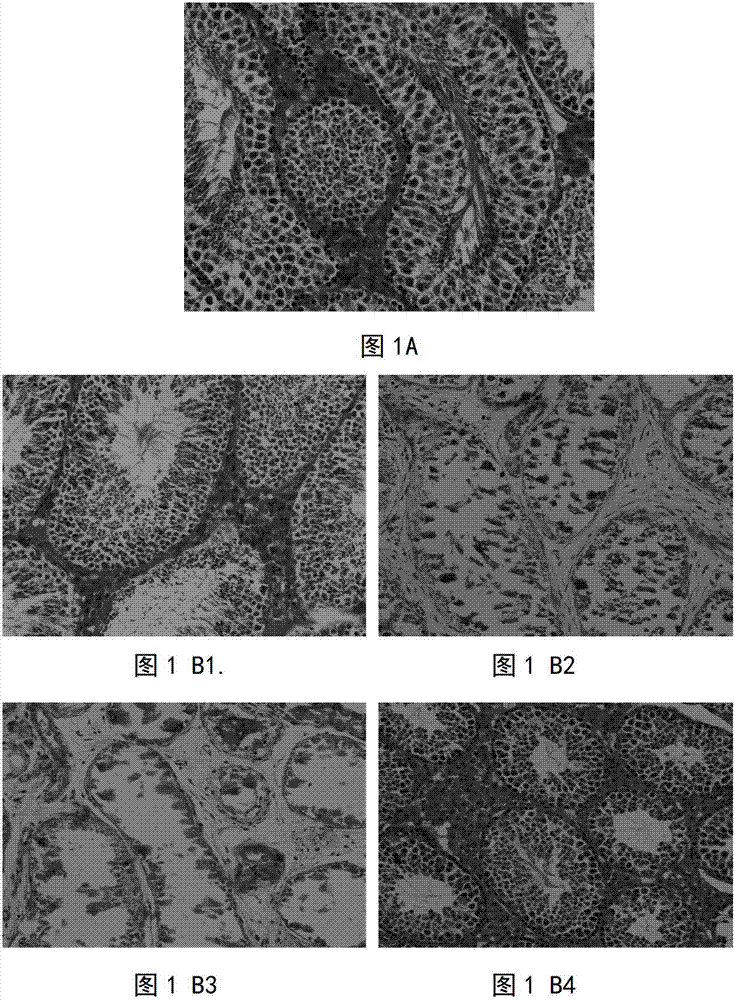 Preparation method of spermatogonial stem cell transplantation receptor