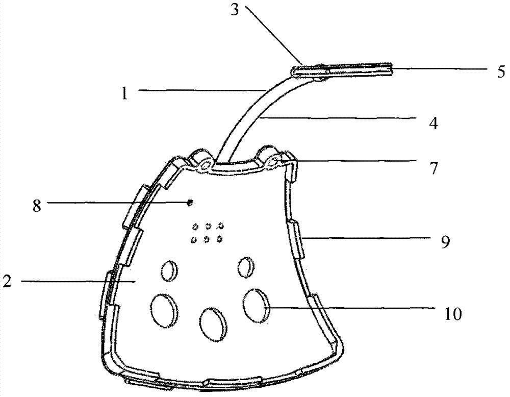 Aqueous humor drainage implant