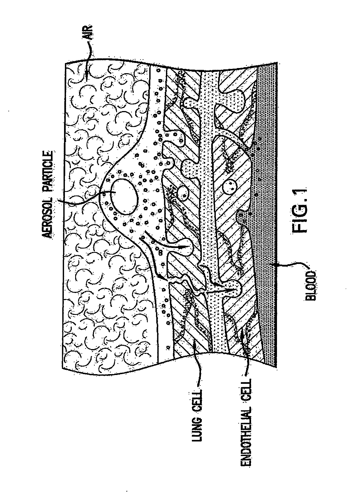 Combination growth factor therapy and cell therapy for treatment of acute and chronic heart  disease