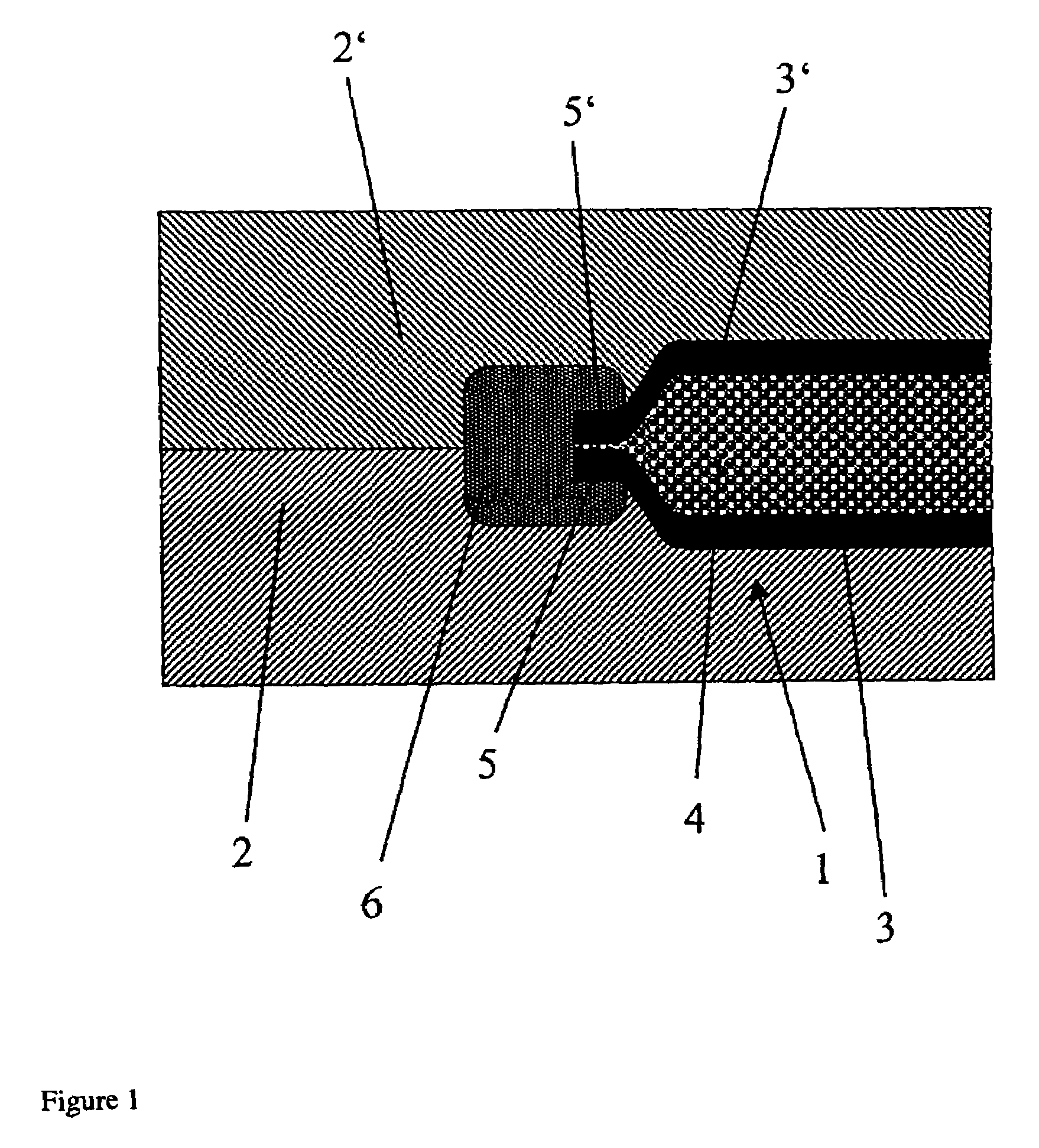 Composite component