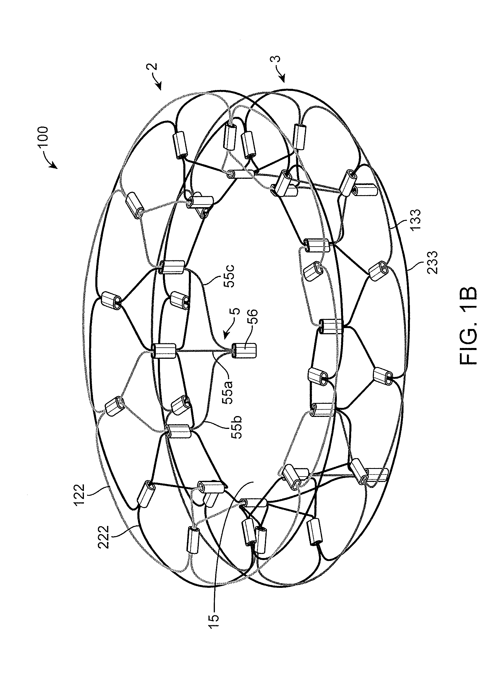 System and method for cardiac valve repair and replacement