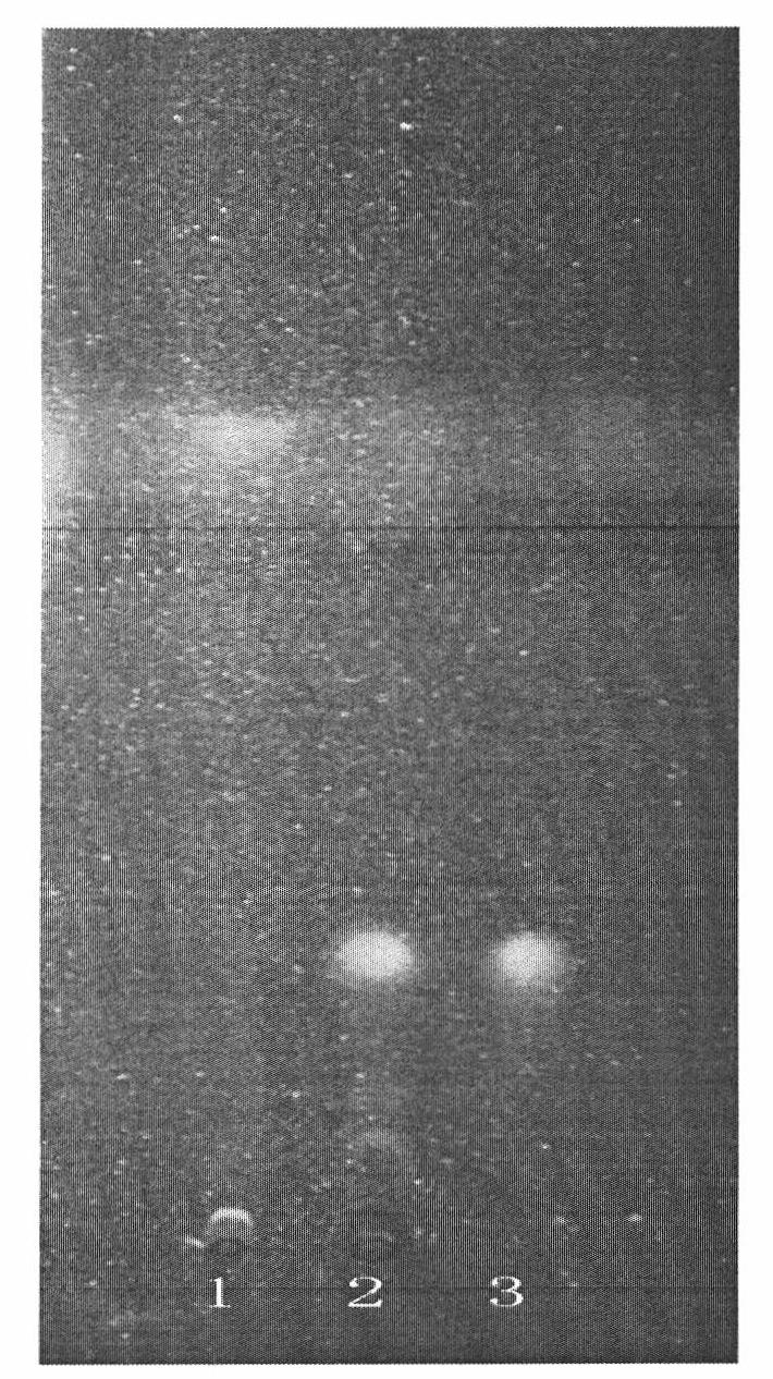 Method for detecting quality of Chinese medicinal composition for treating proliferation of mammary gland