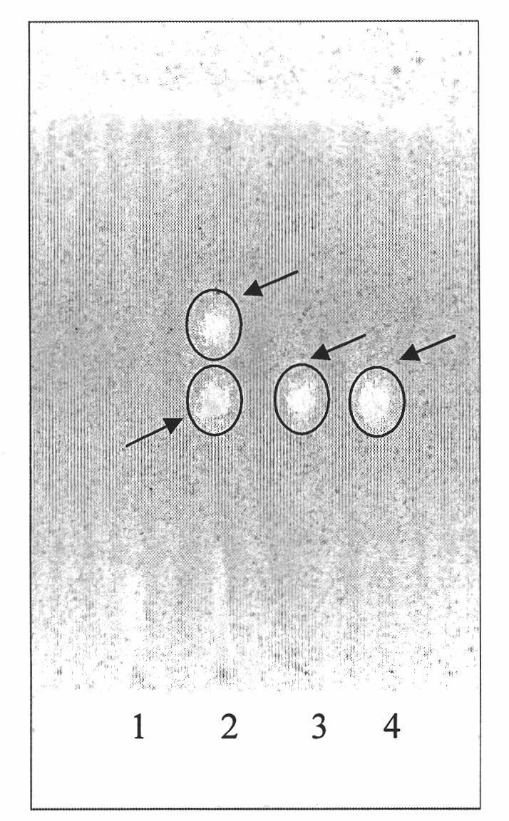 Method for detecting quality of Chinese medicinal composition for treating proliferation of mammary gland