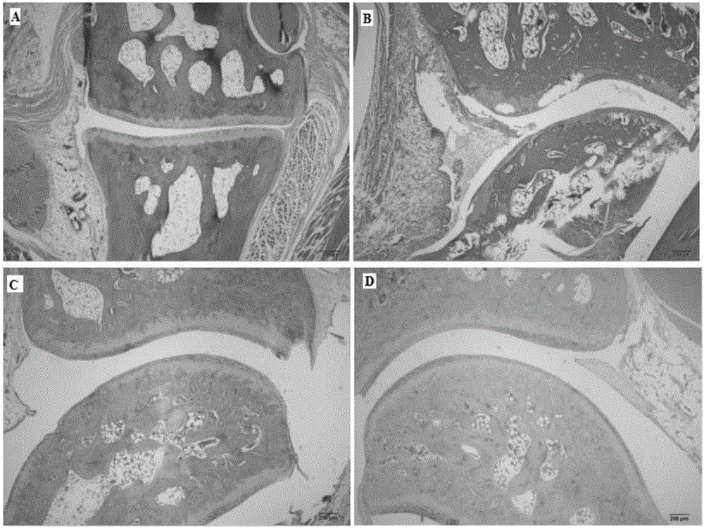 Applications of phenyl naphthalene type lignin in preparation of anti-rheumatoid arthritis drugs