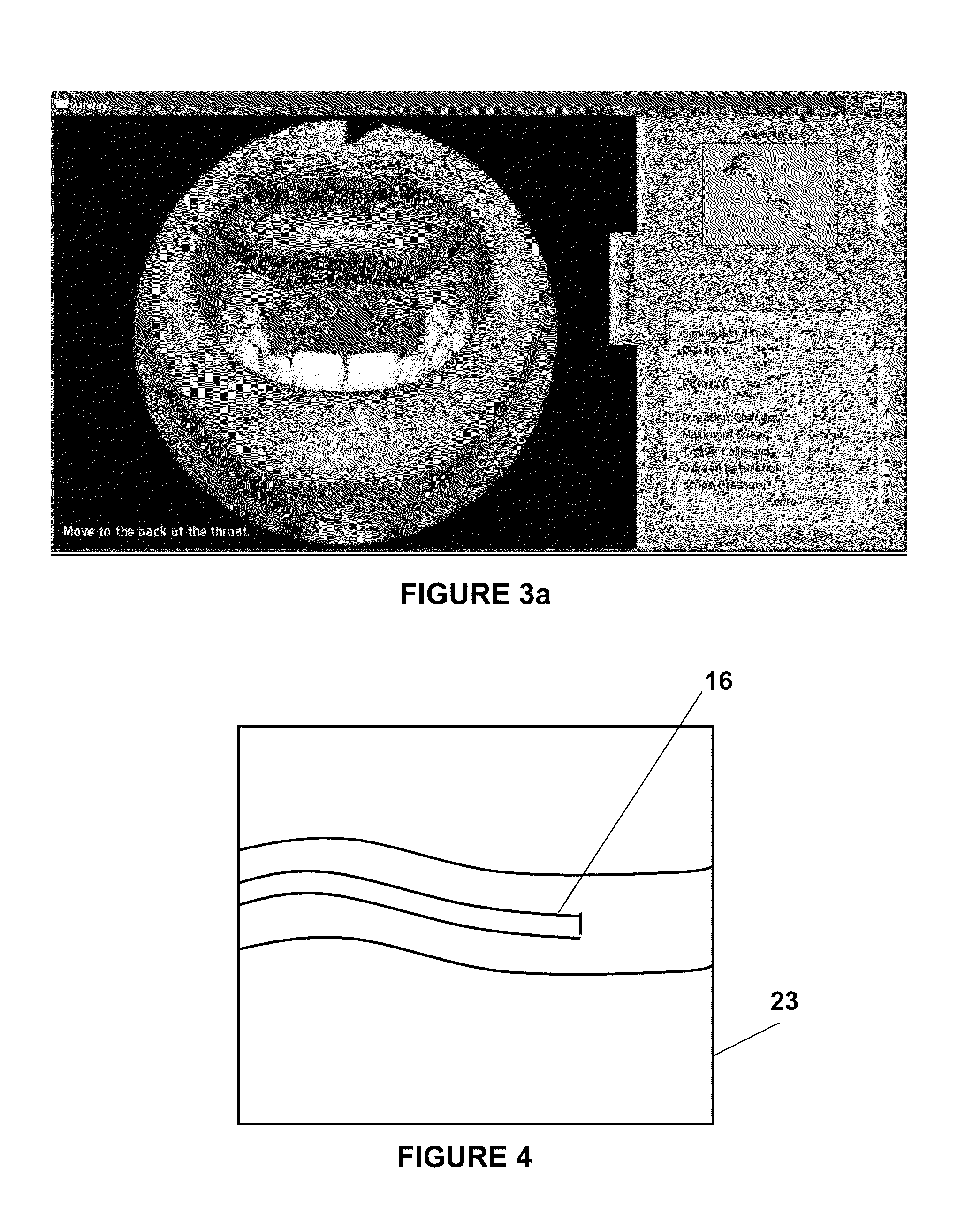 Endoscope Simulator