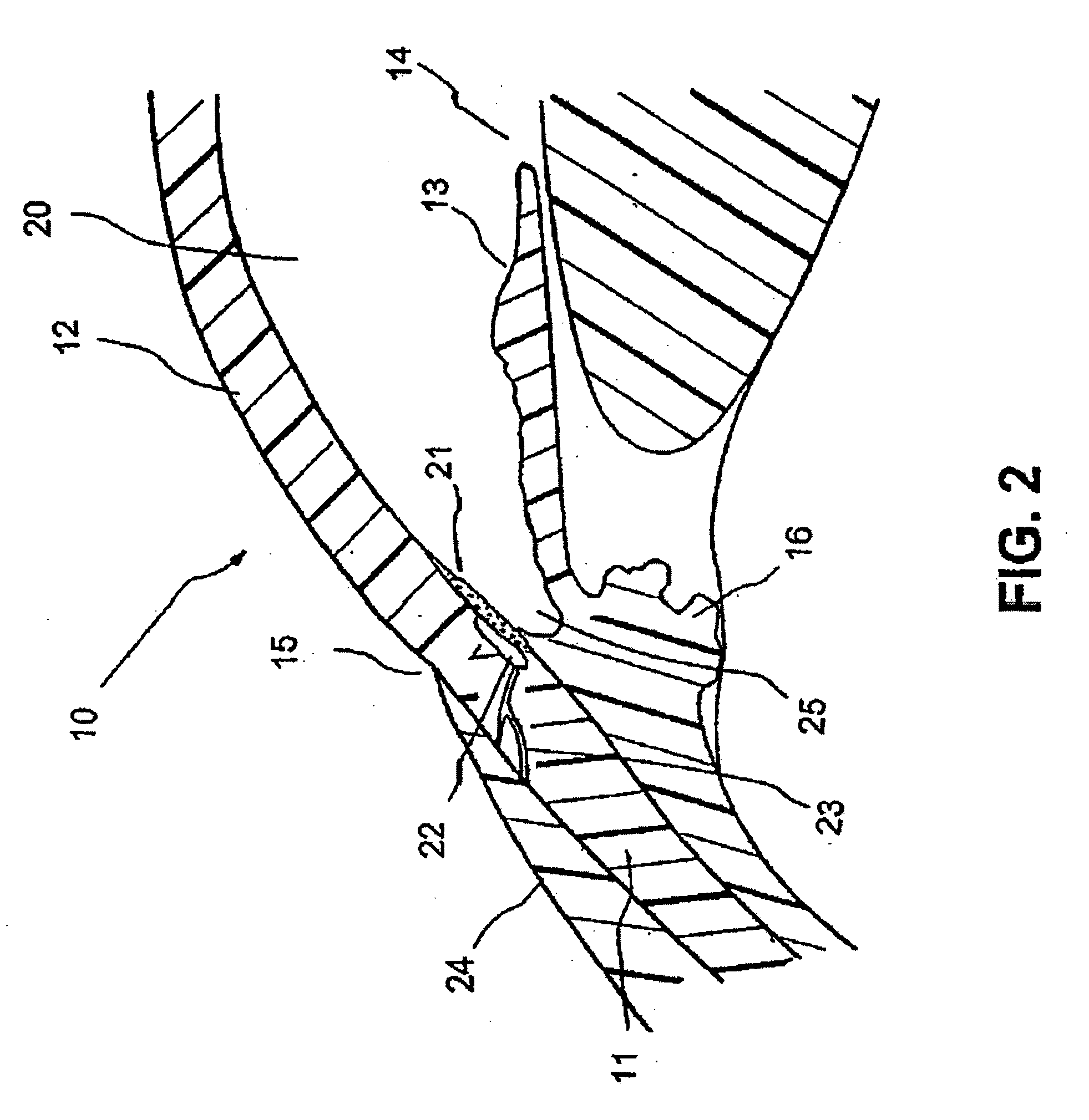 Glaucoma implant with extending members