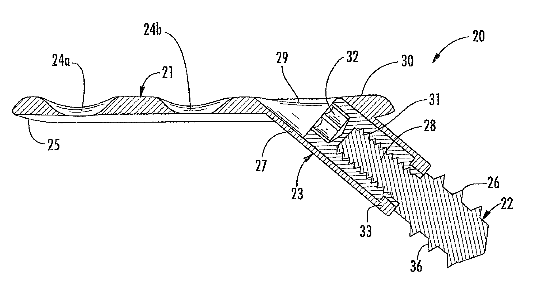 Arthrodesis implant for finger joints and related methods