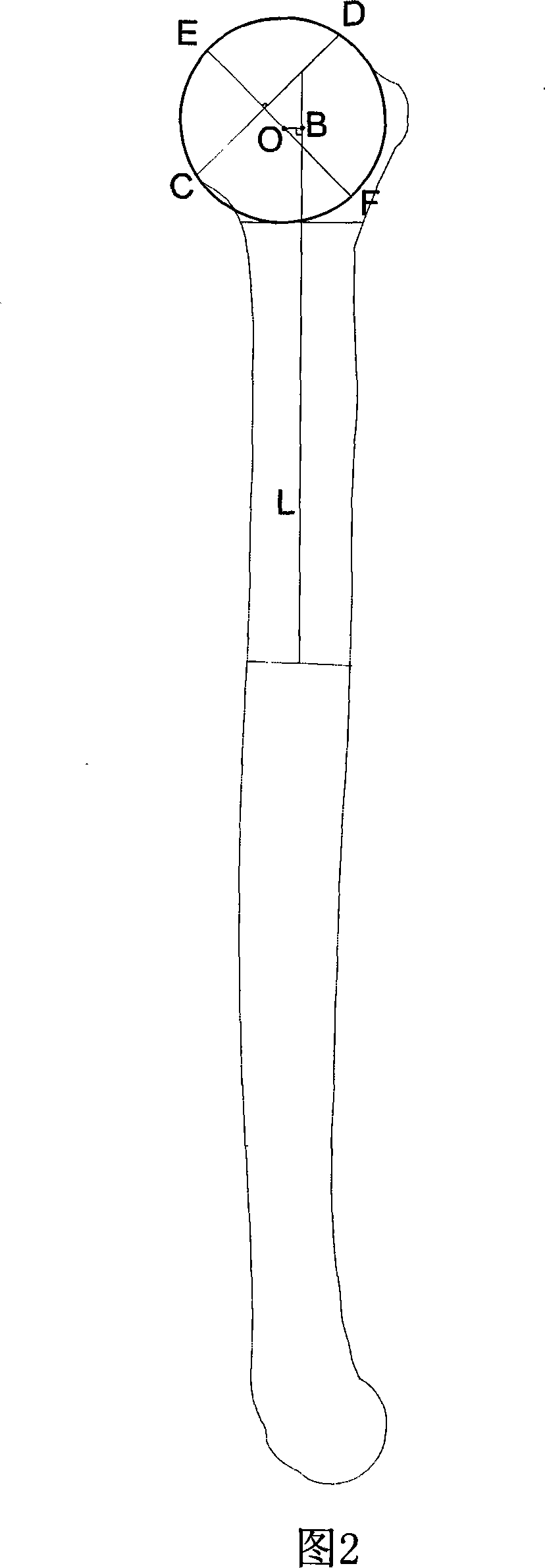 Method for multi-layer spiral CT three-dimensional rebuilding measuring humeral head eccentricity