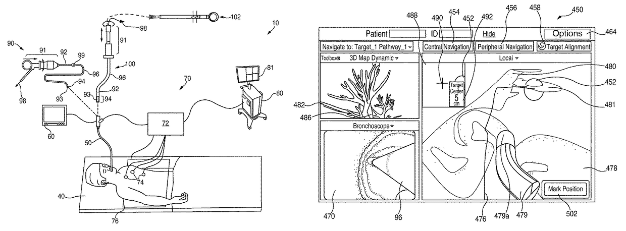 System and method for navigating within the lung