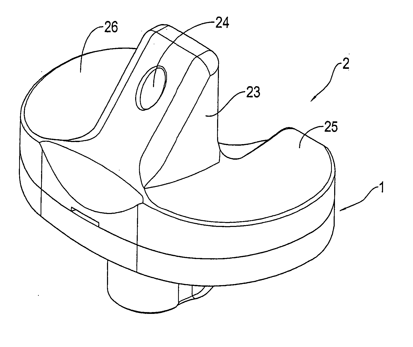 Structure improvement of orthopaedic implant