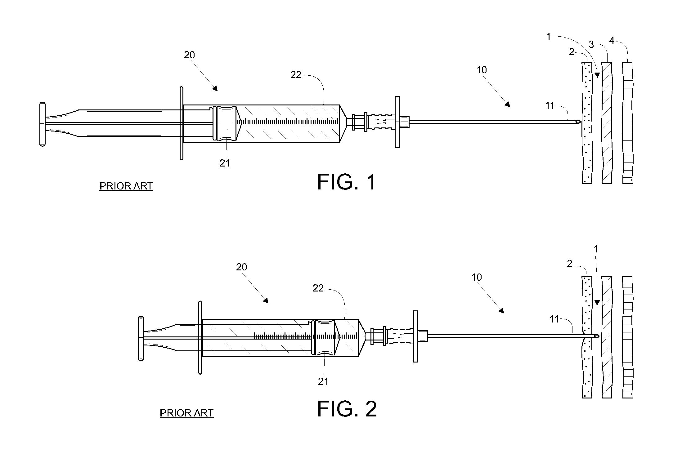 Epidural space locating device