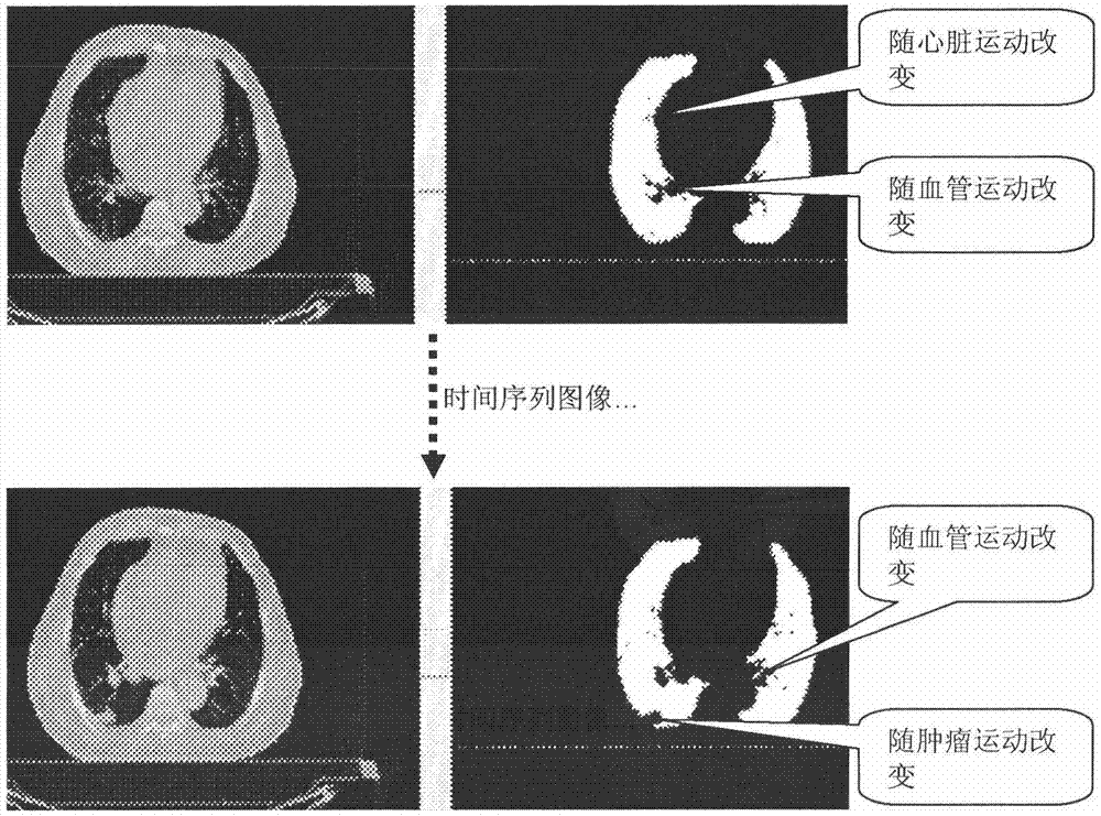 Device-less 4 dimensional-computed tomography (D4D-CT) imaging method, device and system