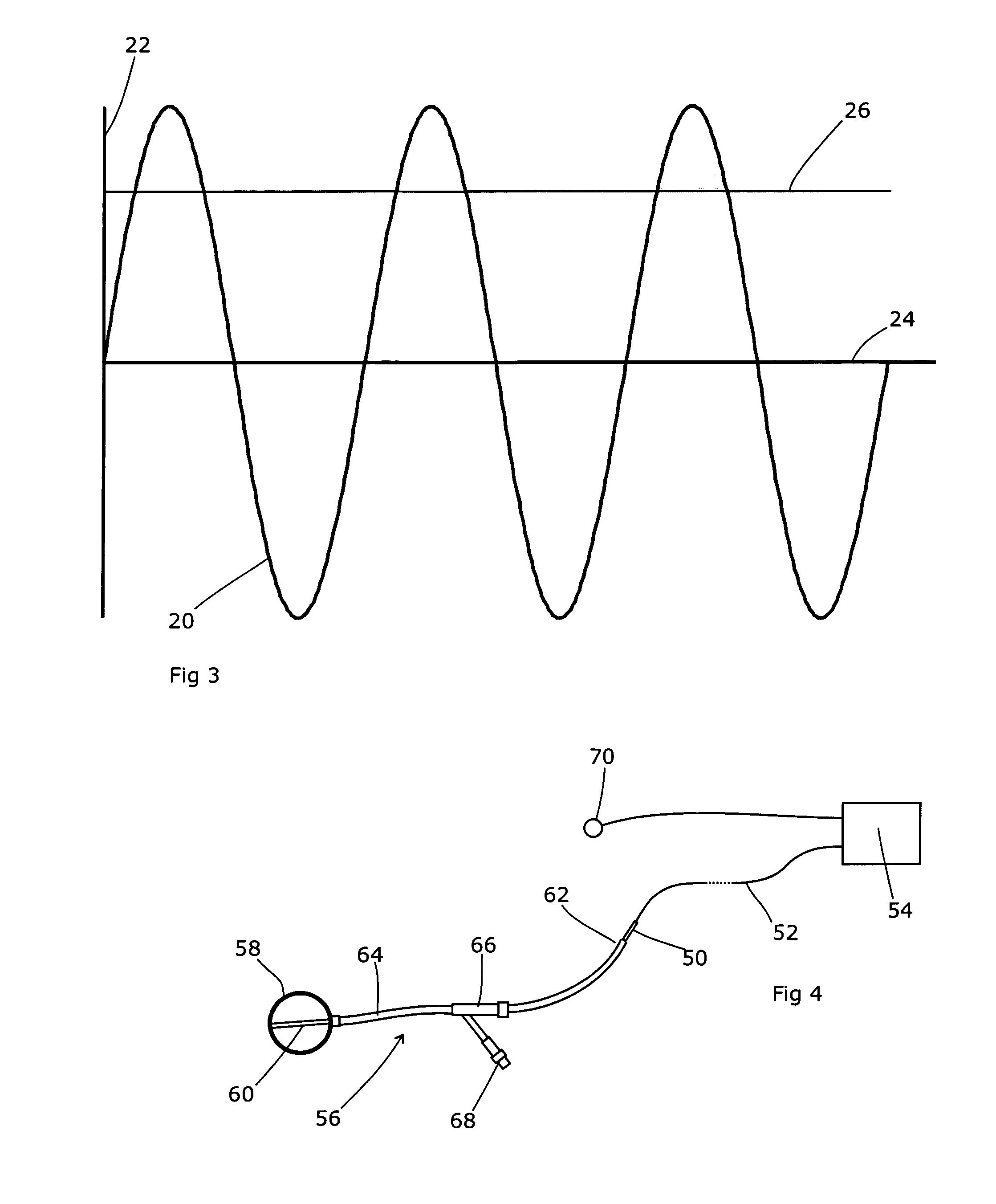 Apparatus for Respiration State Gated Brachytherapy