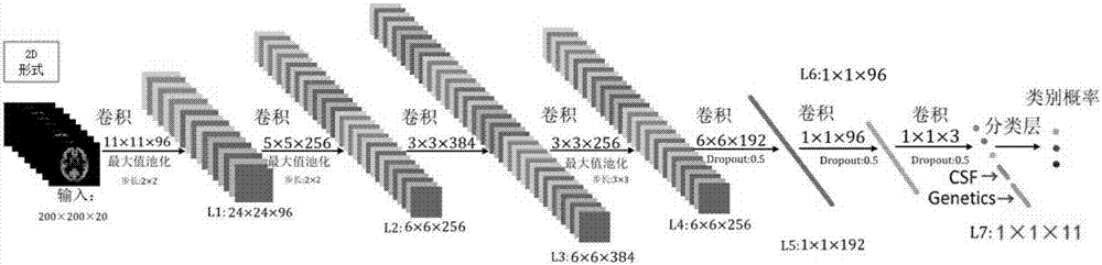 Alzheimer's disease classification method based on depth neural network and multi-mode images