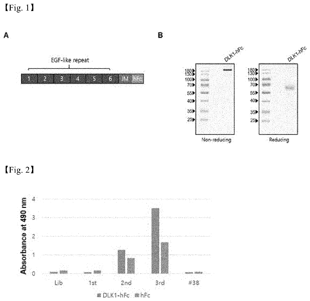 Antibody Against Human DLK1 and Use Thereof