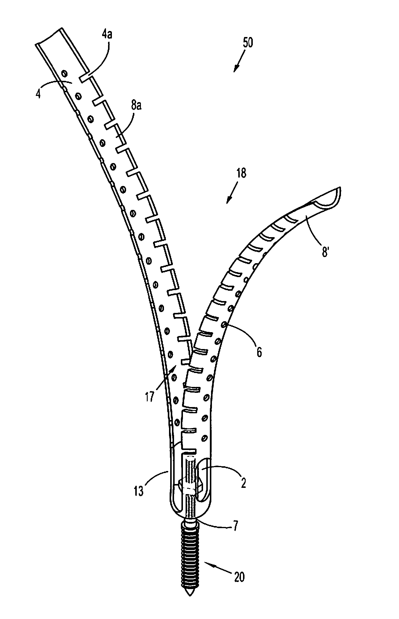 Minimally invasive retractor and posted screw