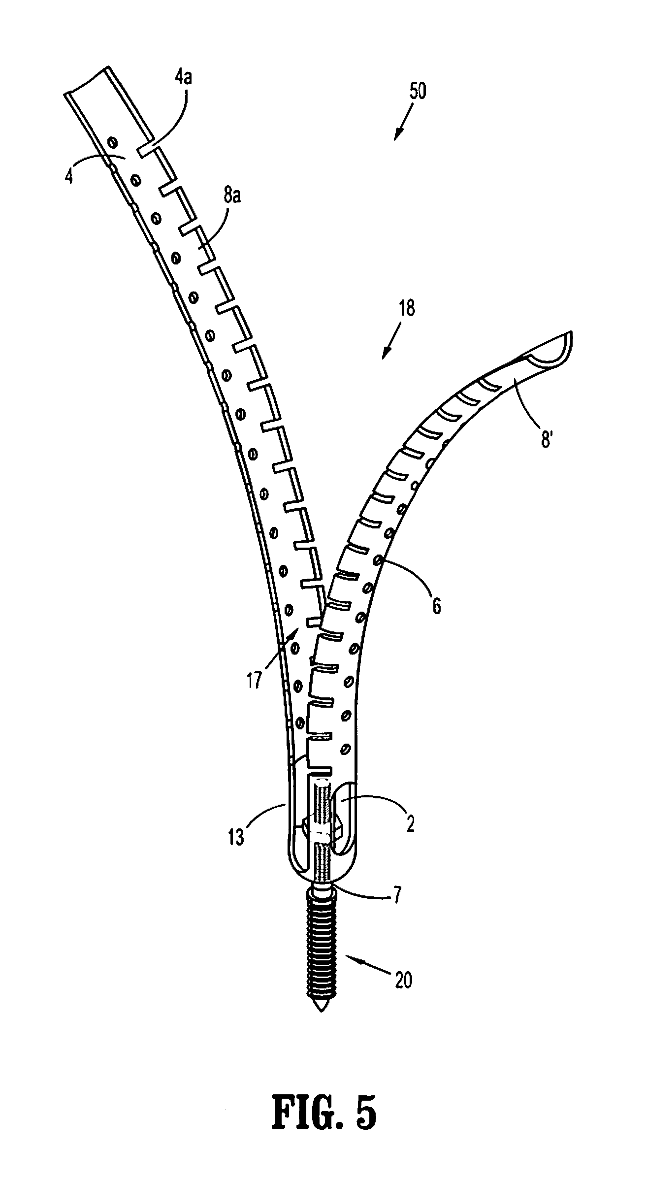 Minimally invasive retractor and posted screw