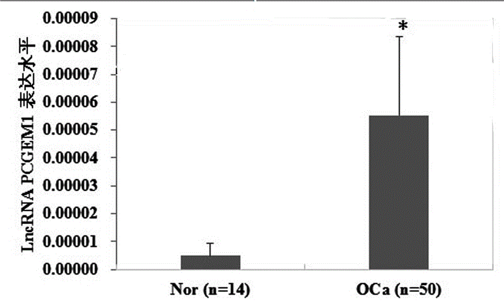 siRNA (small interfering ribonucleic acid) of long noncoding RNA (ribonucleic acid) PCGEM1 (prostate cancer gene expression marker 1) related to ovarian cancer and endometrial cancer and application