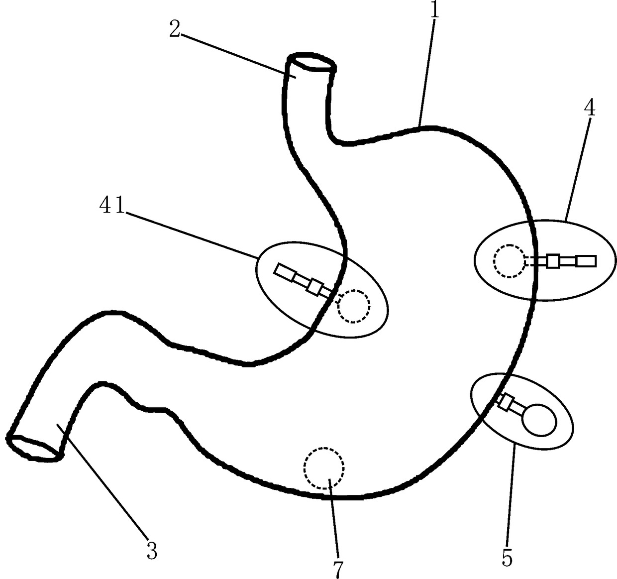 Gastroscope-teaching simulation model