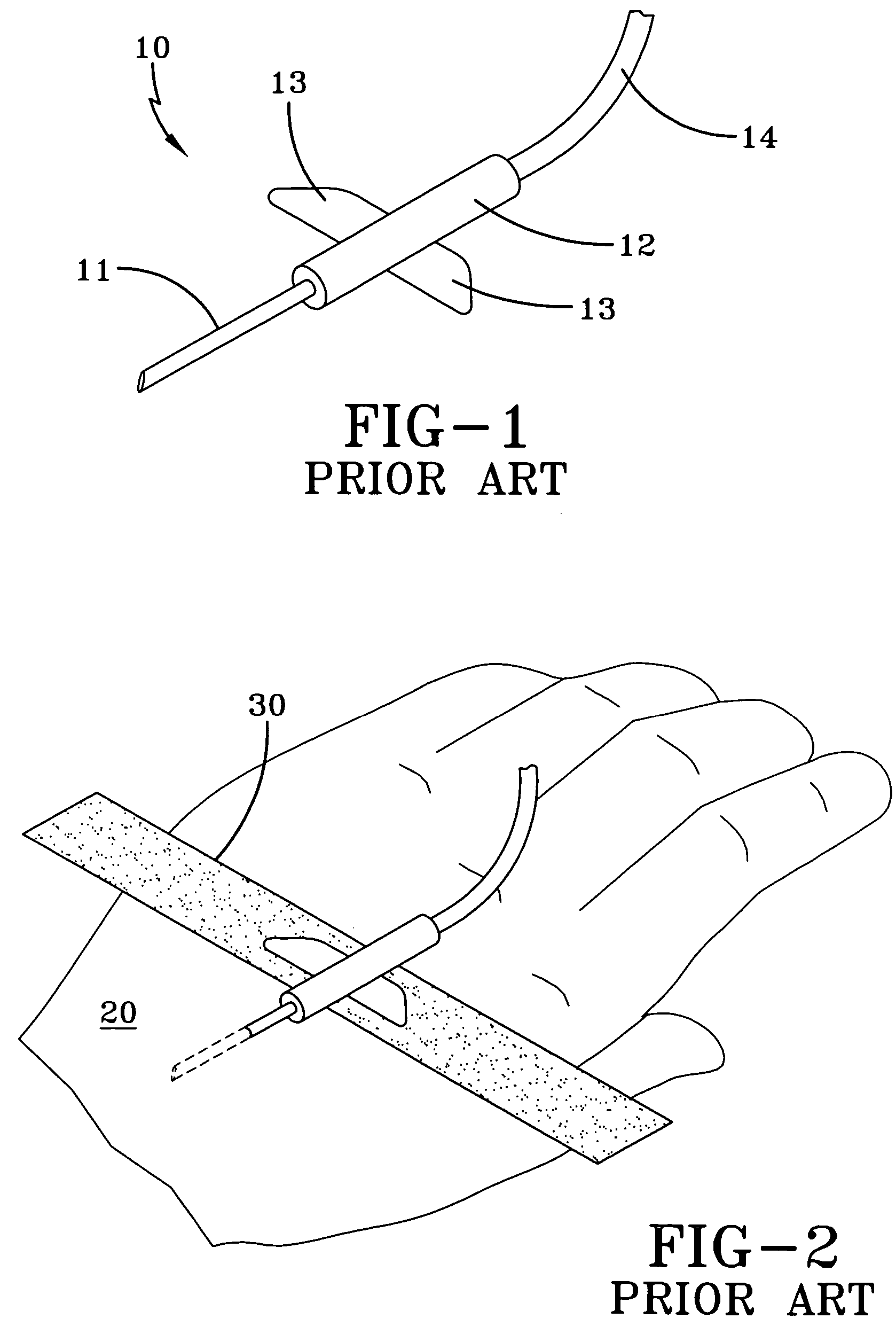 Adhesive tape for an intravascular catheter