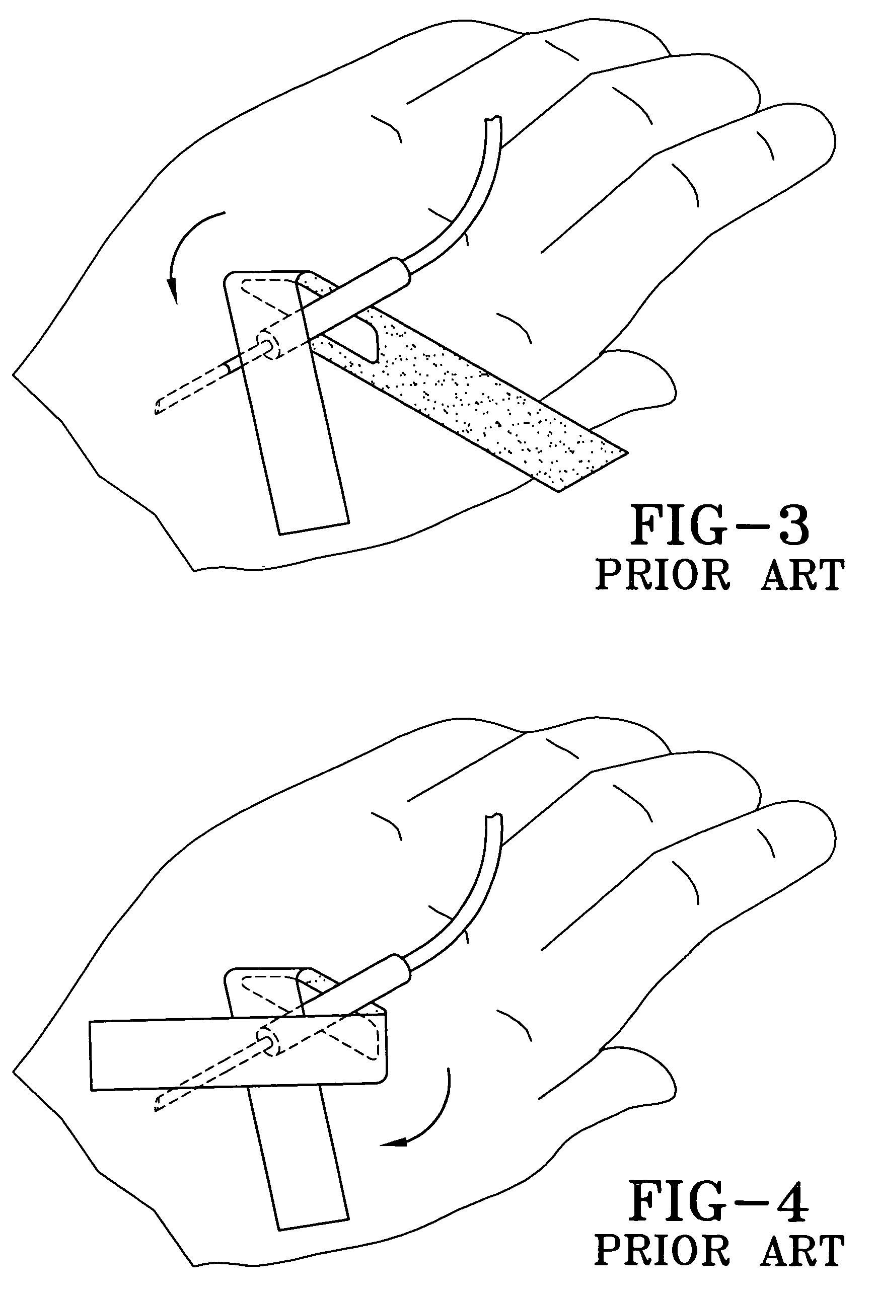 Adhesive tape for an intravascular catheter