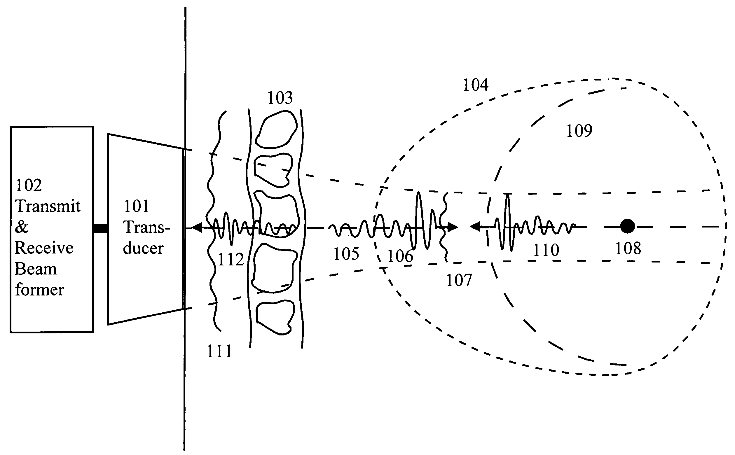 Corrections for wavefront aberrations in ultrasound imaging