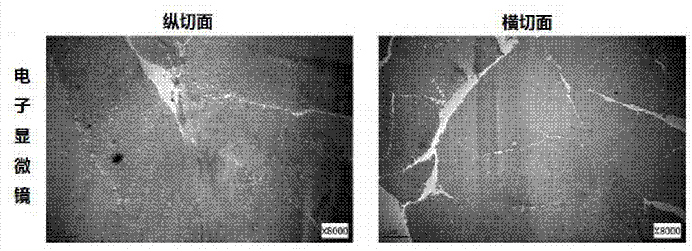 Acellular dermal matrix and preparation method and application thereof