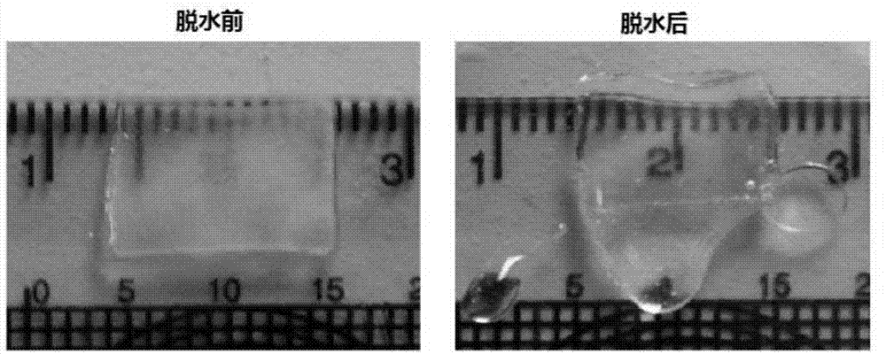 Acellular dermal matrix and preparation method and application thereof