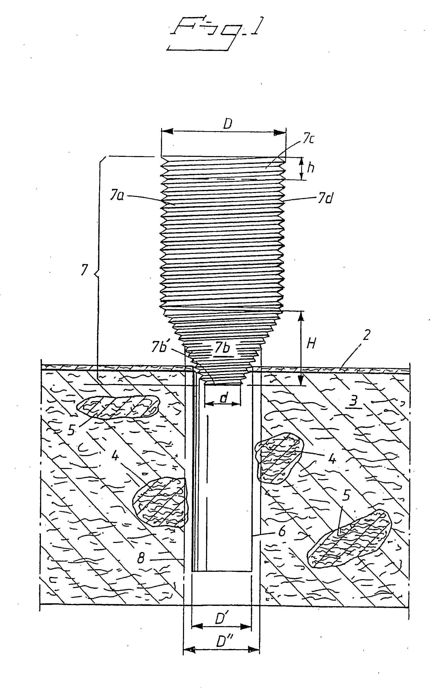 Fixture for anchoring in jaw bone