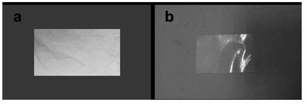 A kind of oral instant film containing rizatriptan benzoate and preparation method thereof