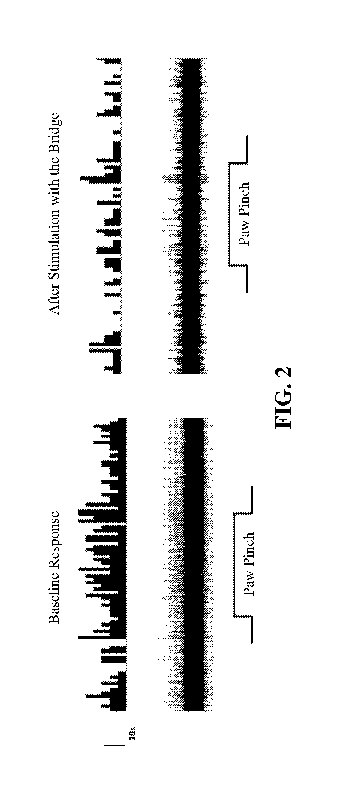 Methods of treating disease using auricular peripheral nerve field stimulation