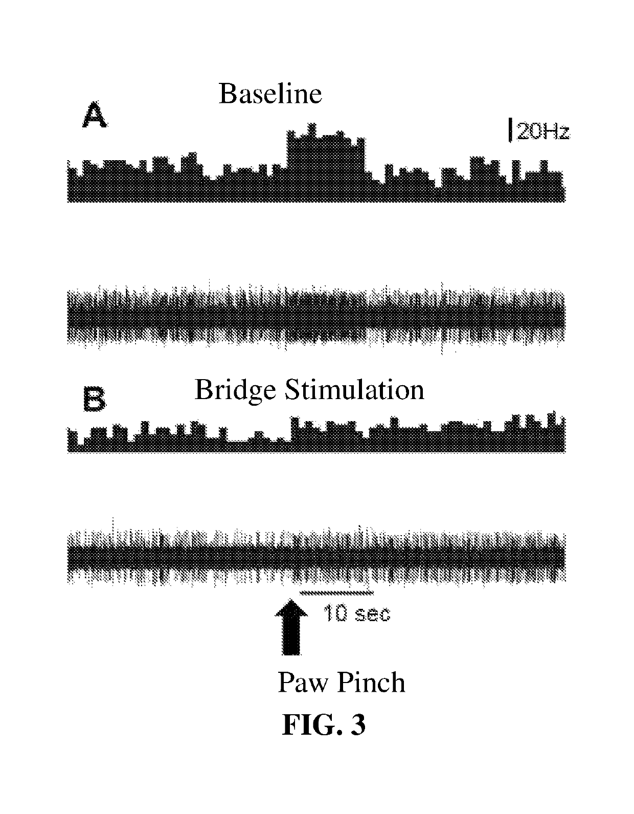 Methods of treating disease using auricular peripheral nerve field stimulation