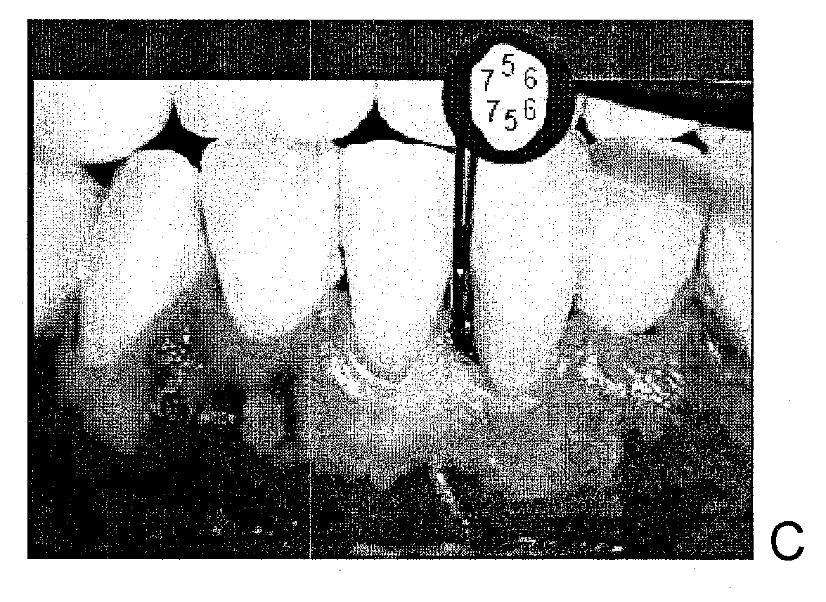 Combination of an oxidant, a photosensitizer and a wound healing agent for oral disinfection and treatment of oral disease