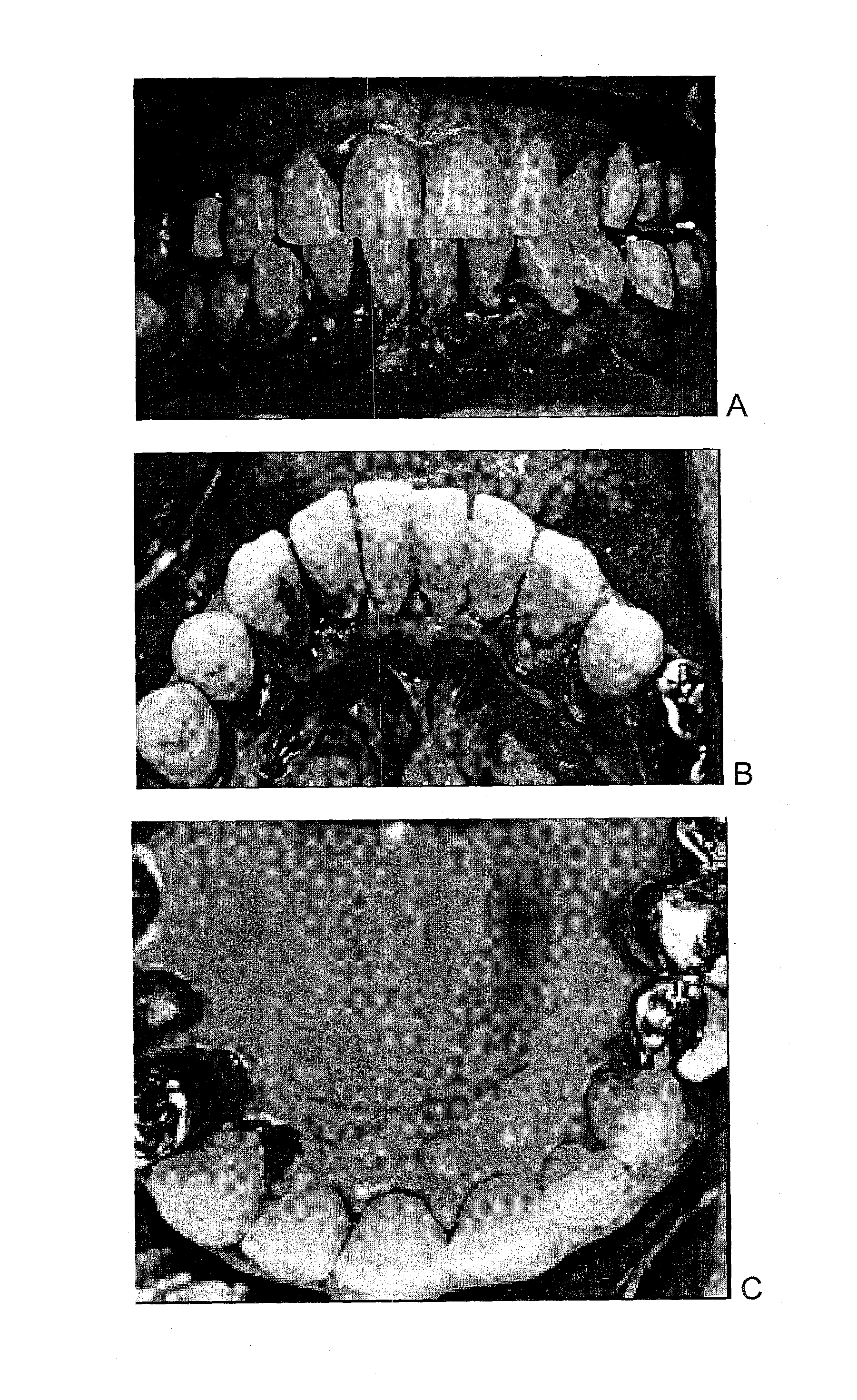 Combination of an oxidant, a photosensitizer and a wound healing agent for oral disinfection and treatment of oral disease