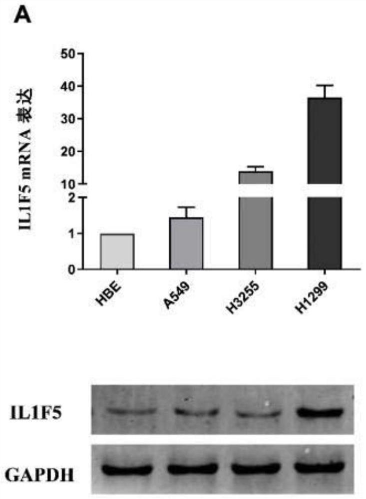 Lung adenocarcinoma related diagnostic marker and application thereof