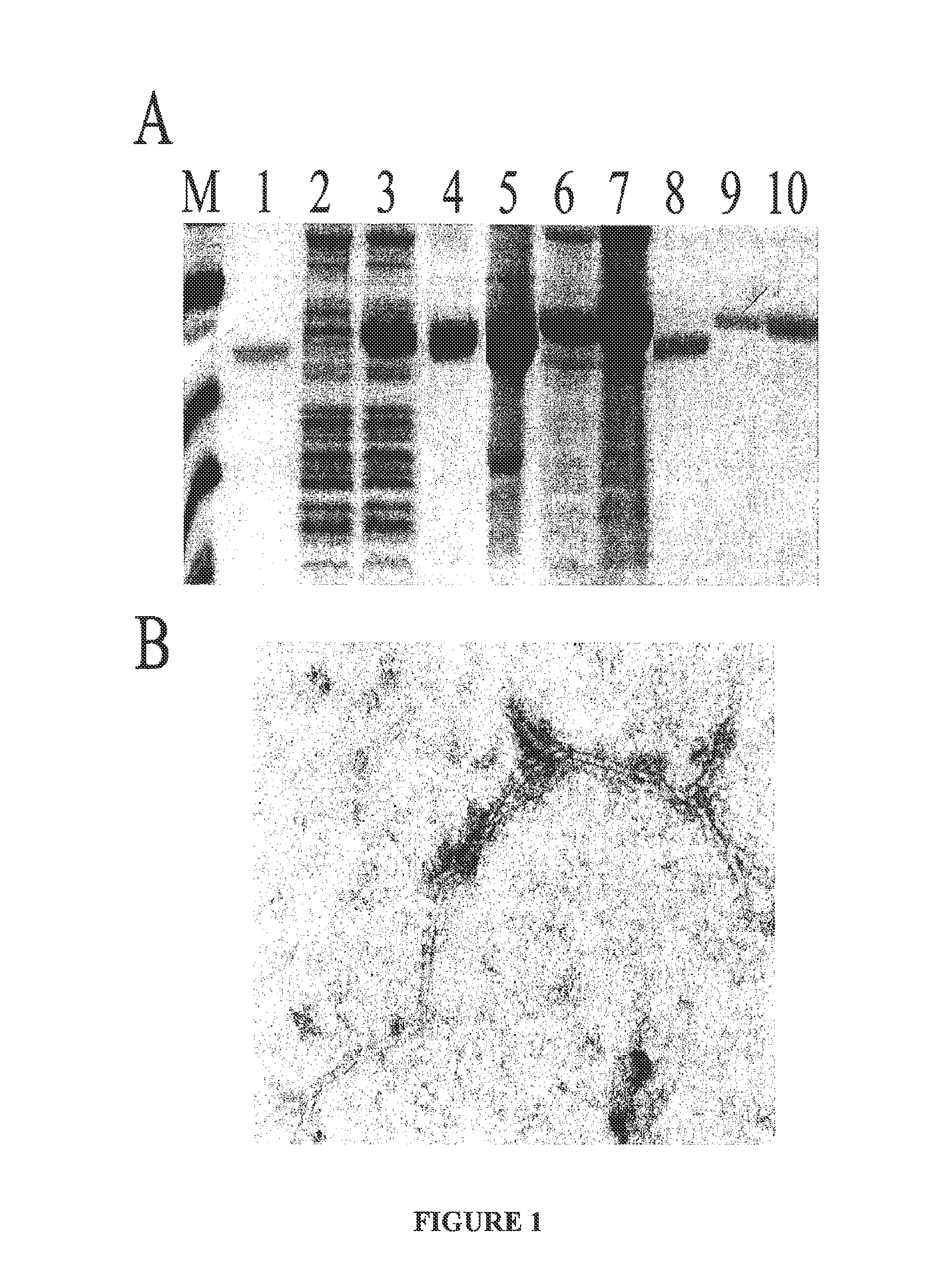 Vaccines and immunopotentiating compositions and methods for making and using them