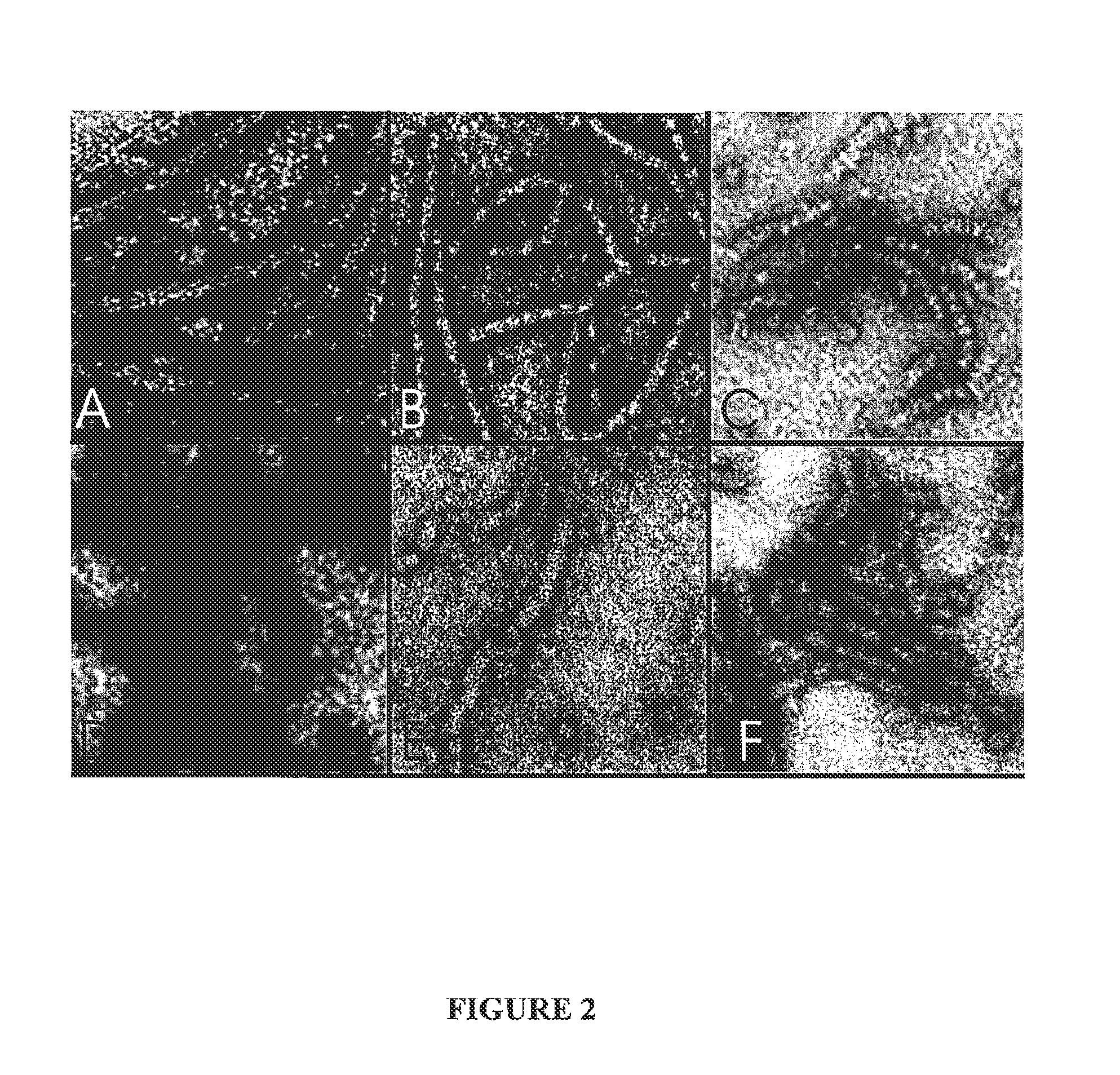 Vaccines and immunopotentiating compositions and methods for making and using them