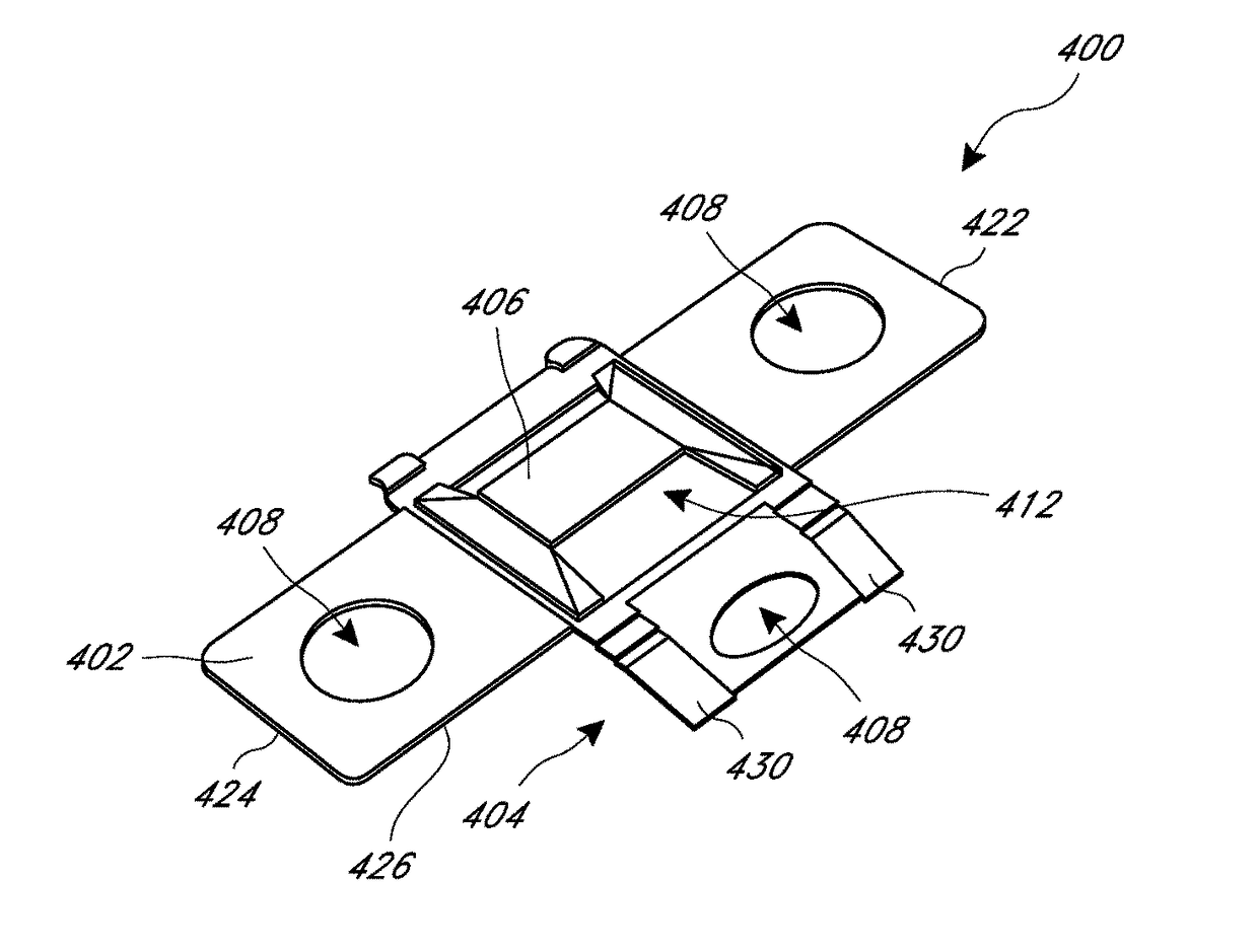 Bone plate for reducing angular bone deformity and method of using