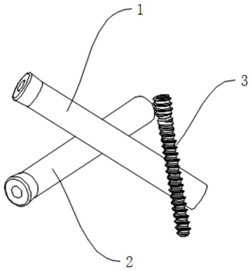 Minimally invasive calcaneal fracture fixing nail guiding system and using method