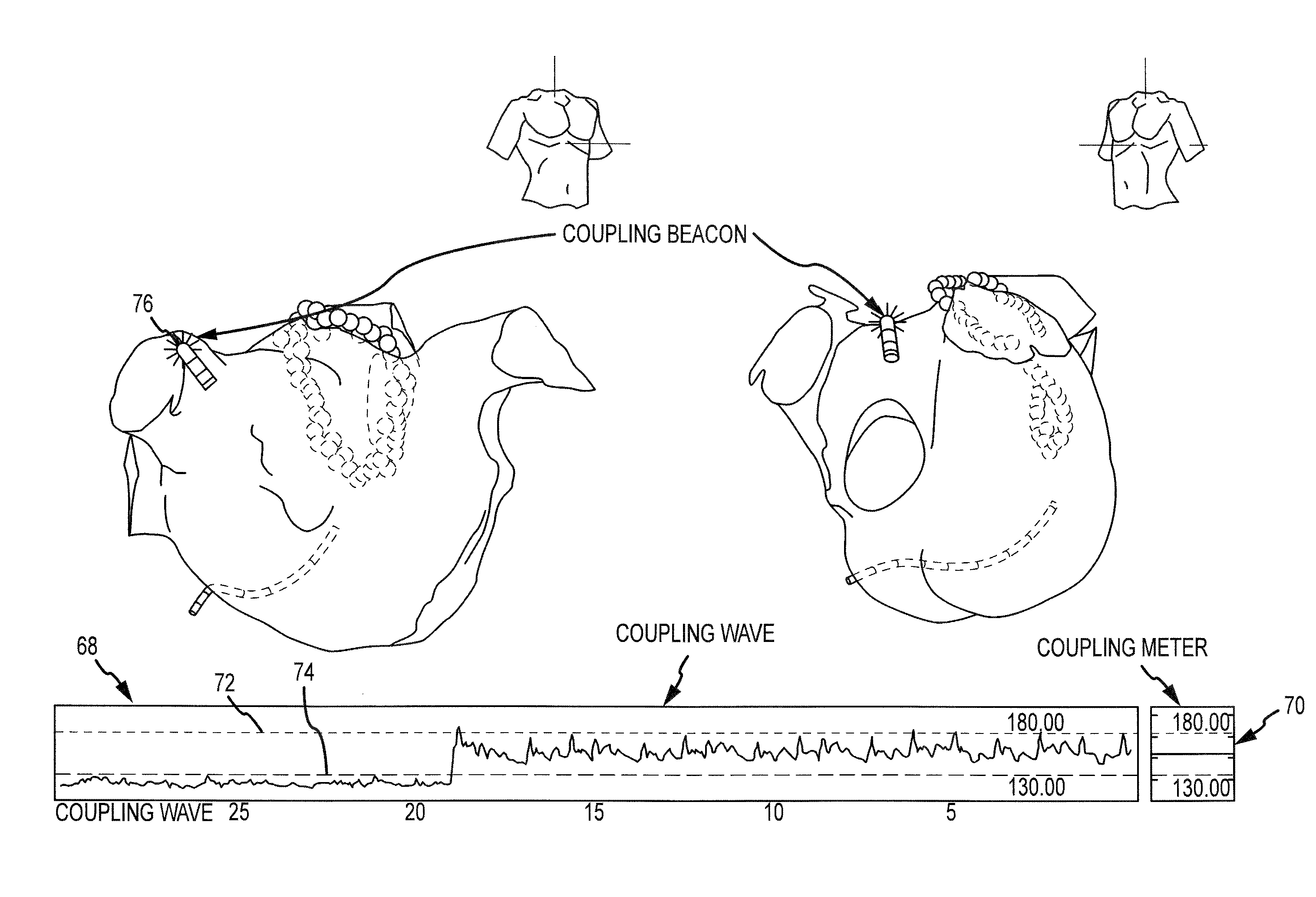 System and method for assessing coupling between an electrode and tissue