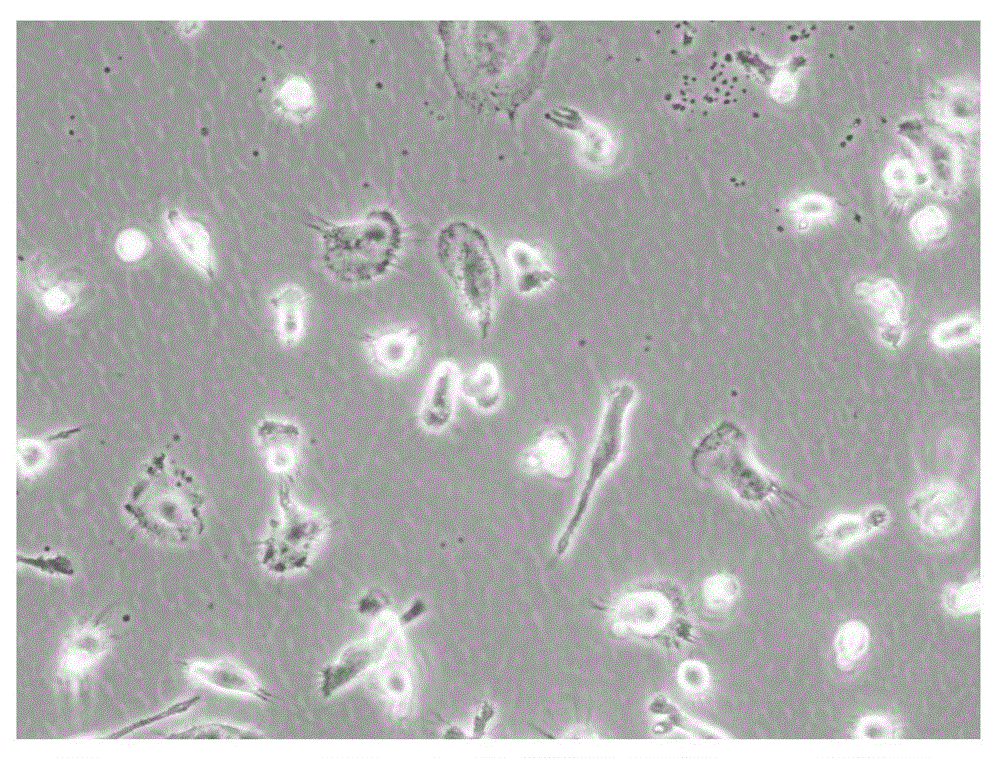 Cell CTL (BiAT) with bispecific antibody as well as preparation method and application thereof