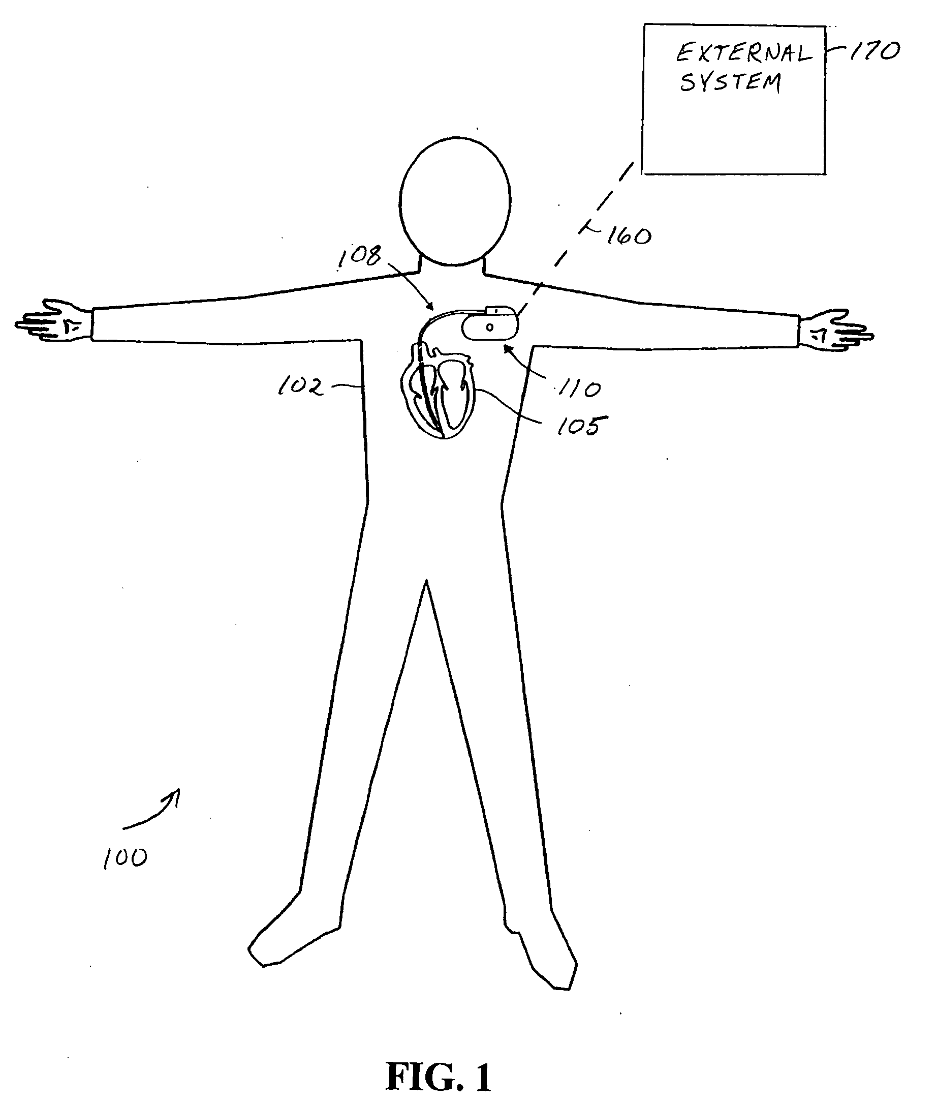 Systems and methods for valvular regurgitation detection