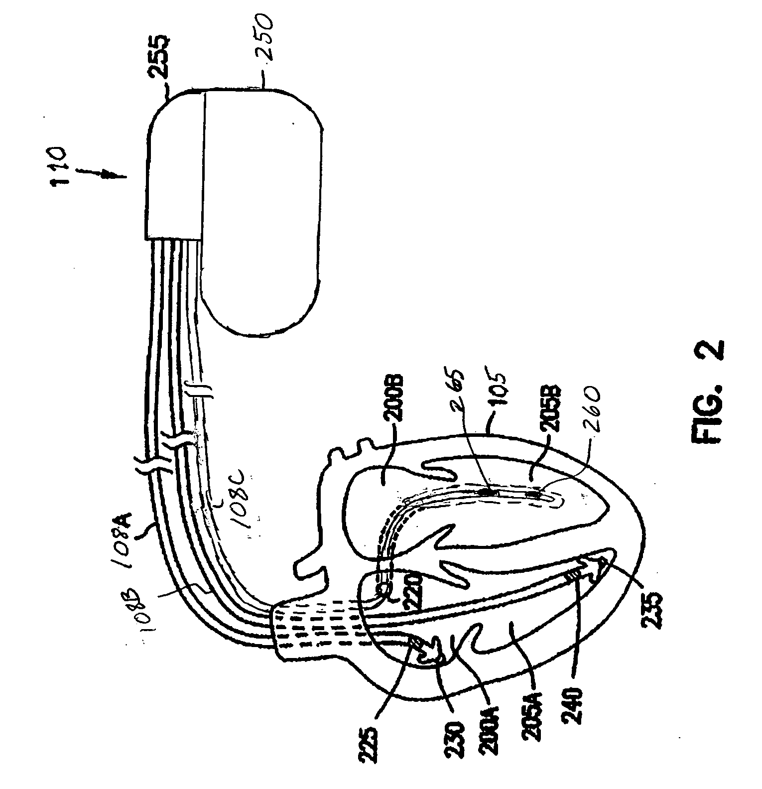 Systems and methods for valvular regurgitation detection