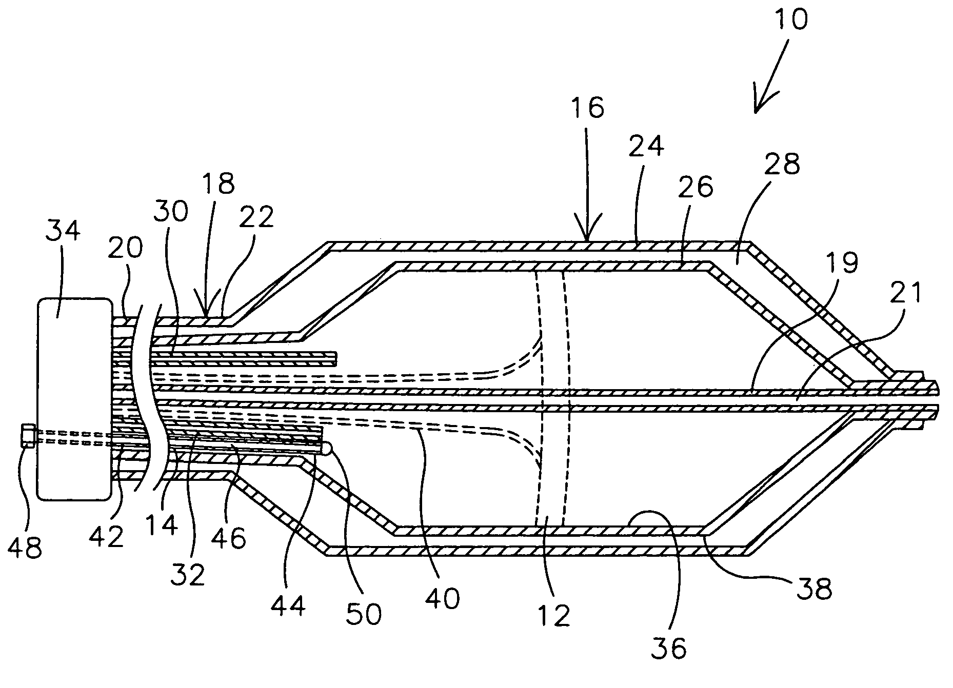 Cryo balloon