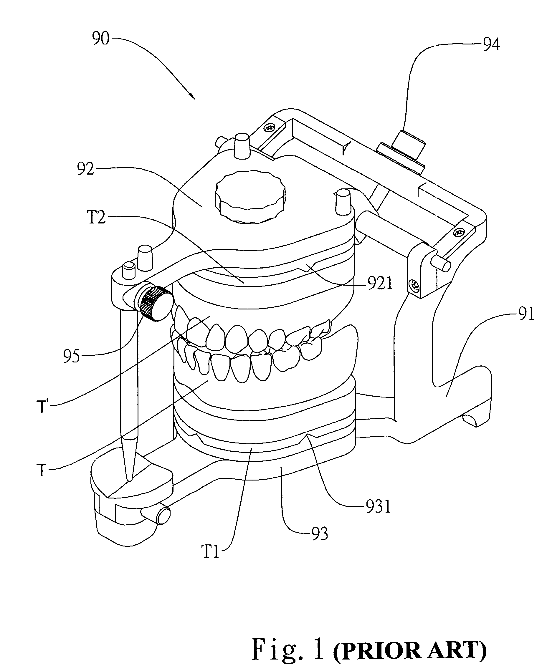 Tooth mold retaining frame