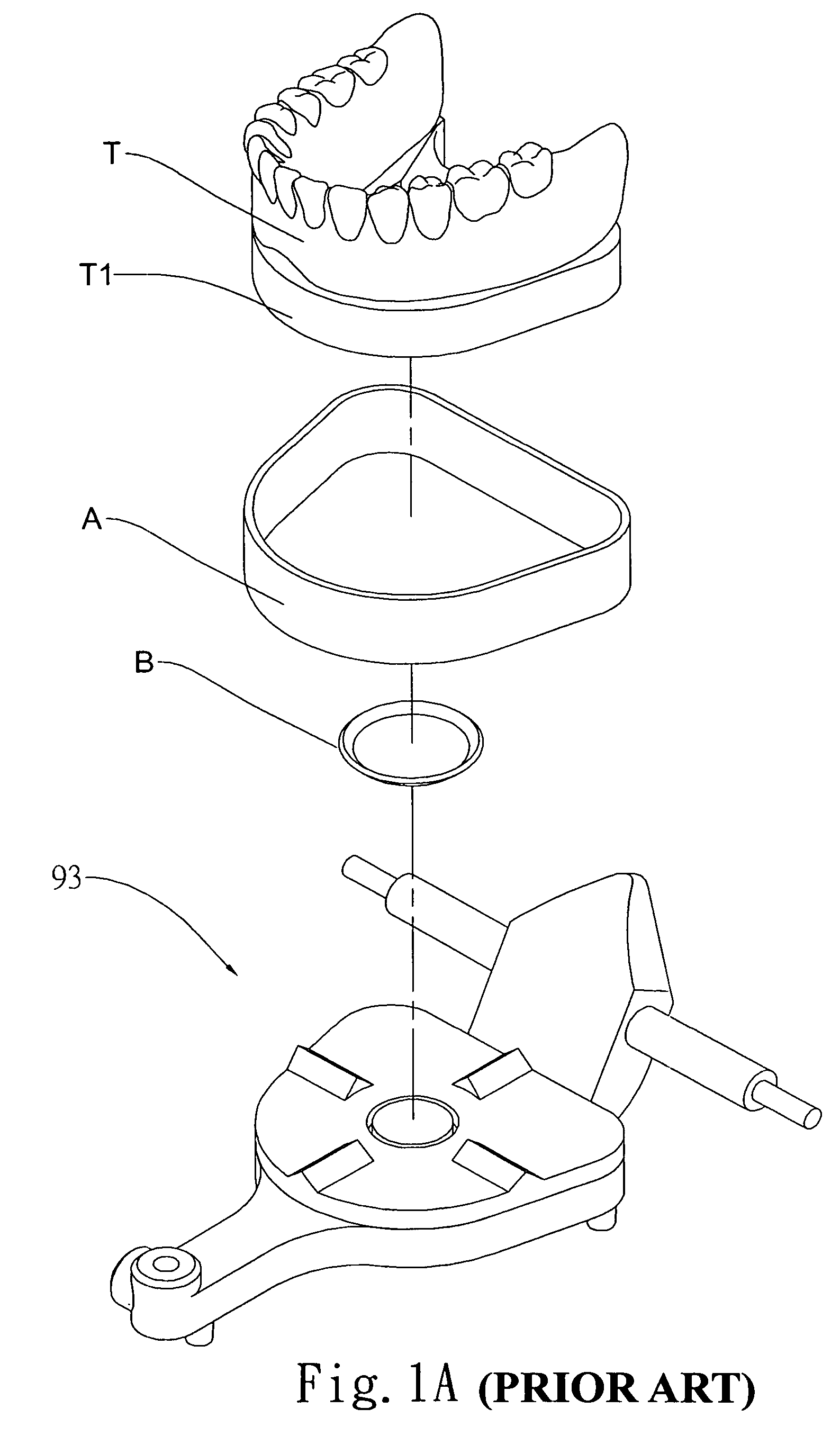 Tooth mold retaining frame